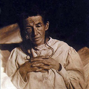 Auguste Deter (1850-1906), pacjentka Aloisa Alzheimera fot. Wikimedia